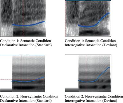 Intonation processing of interrogative words in Mandarin: an event-related potential study